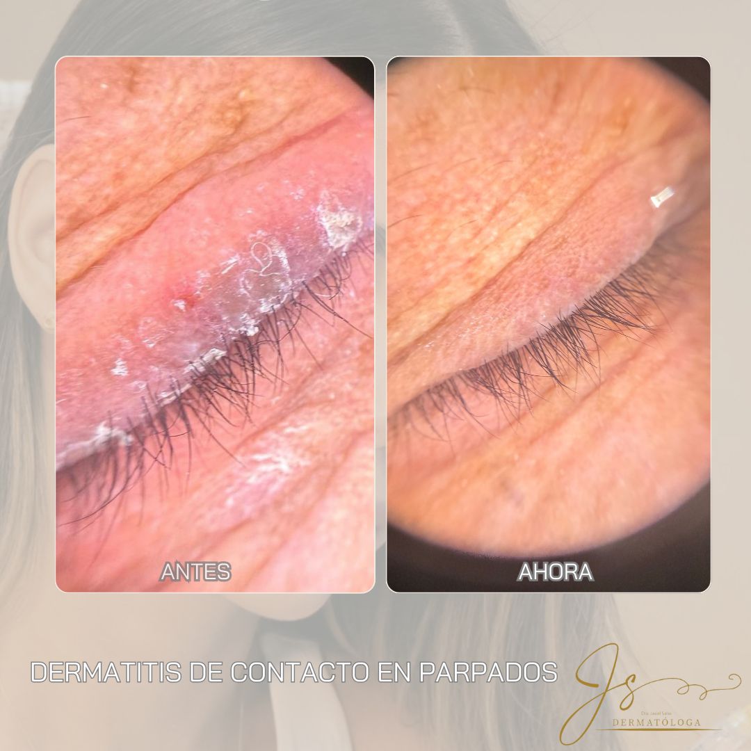 Jasiel Sarai Salas Gomez-9