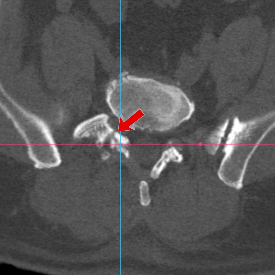 David Tafur Muñoz-2308