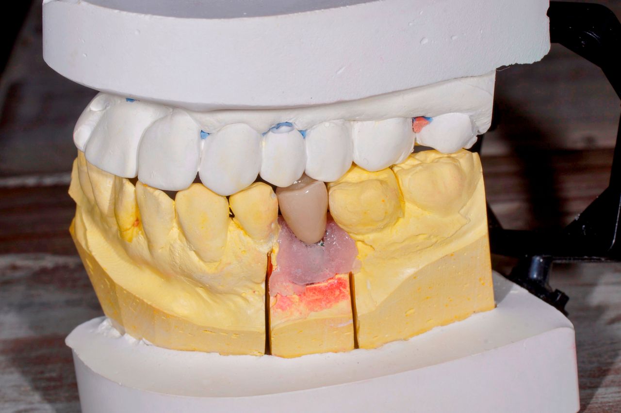 Hernán Andrés Febre Moscoso-18