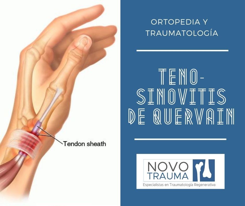 Julia Rosa Vasquez Loyola-5