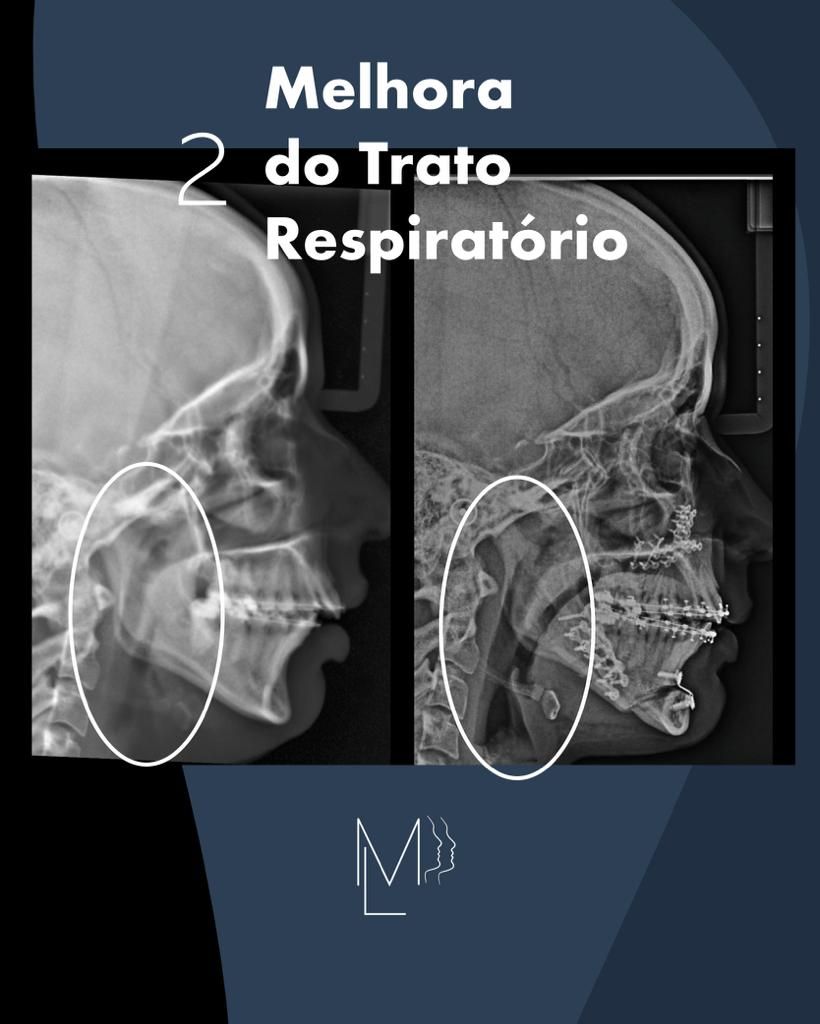 Mauricio Lins Moura-13