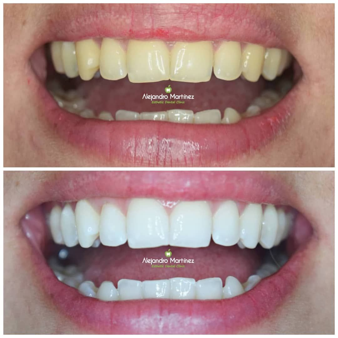 Alejandro Martinez-13