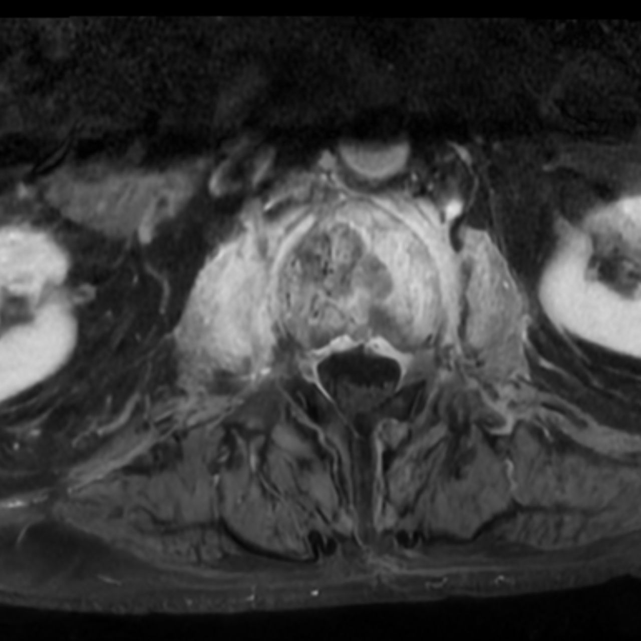 David Tafur Muñoz-1658