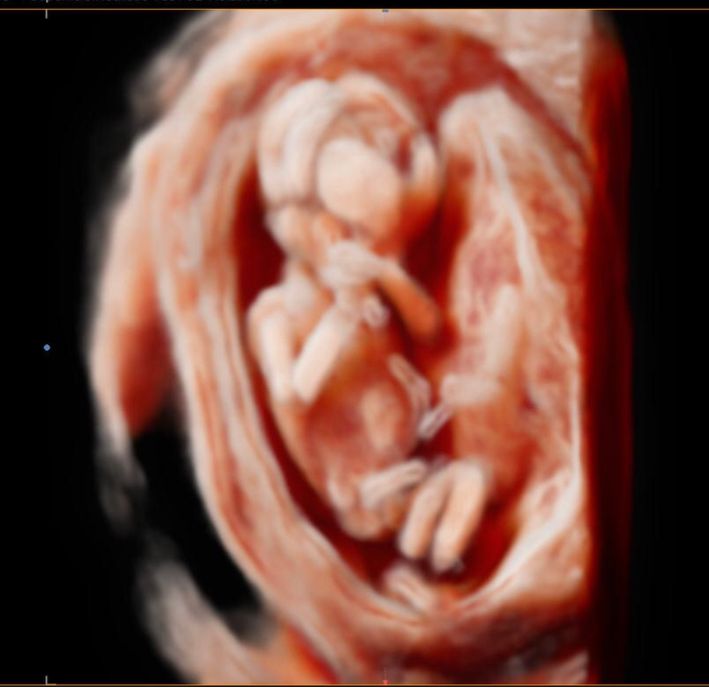 Jonh Harold Alvis Botello-19