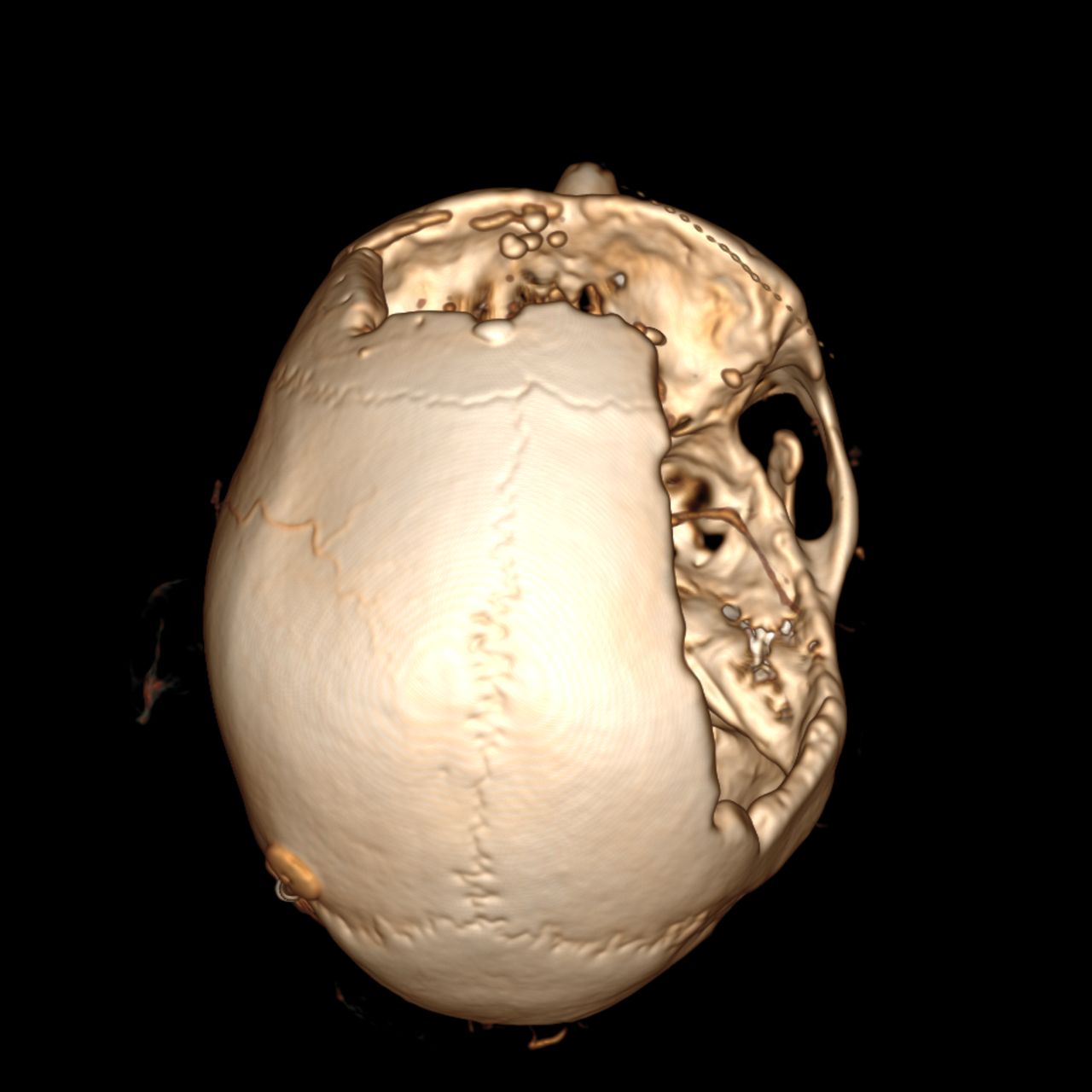 David Tafur Muñoz-1333