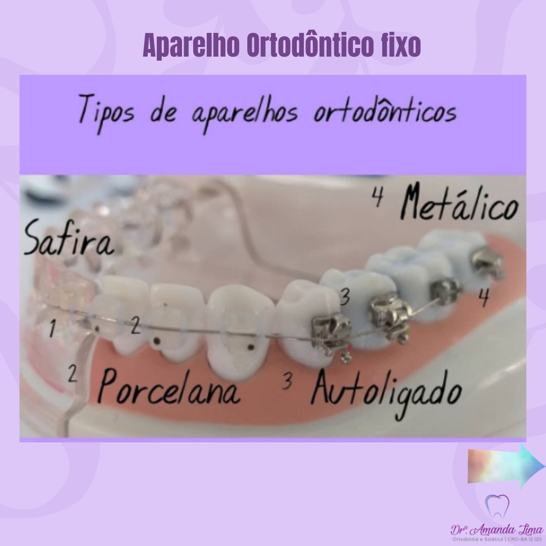 Amanda Lima Fortuna-1