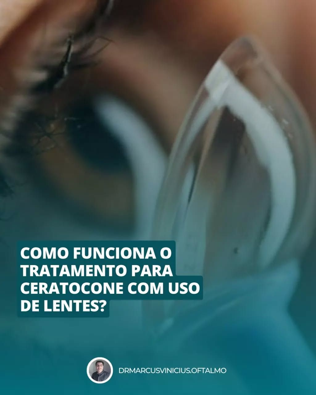 Marcus Vinicius De Oliveira Freitas-9