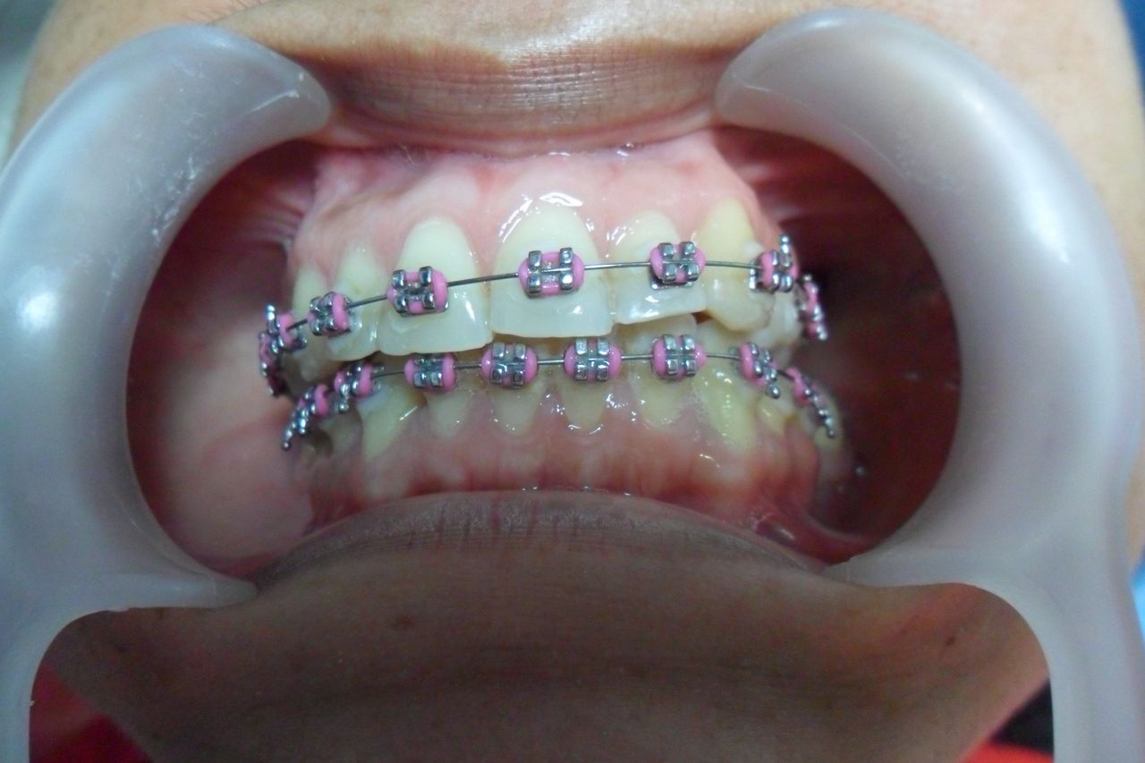 Miguel Angel Bustos Real-19