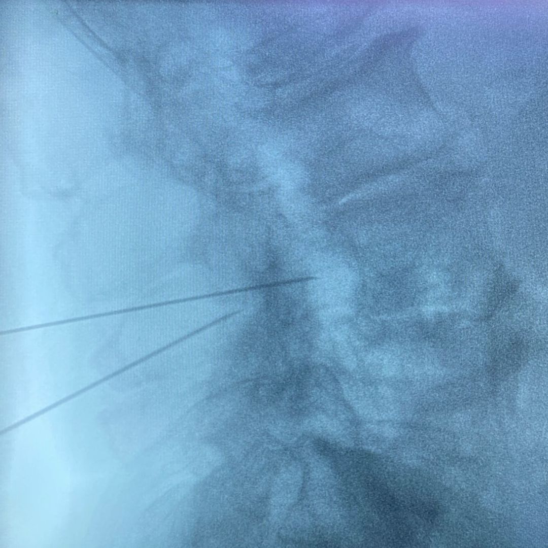 David Tafur Muñoz-2224