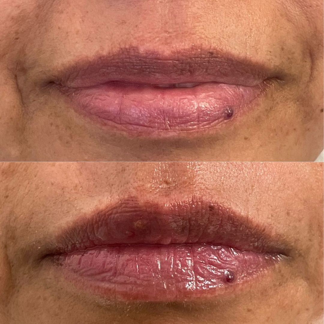 Scarlett Bartsch Ferrada-36