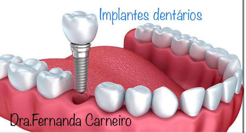 Fernanda Carneiro Pinto-30