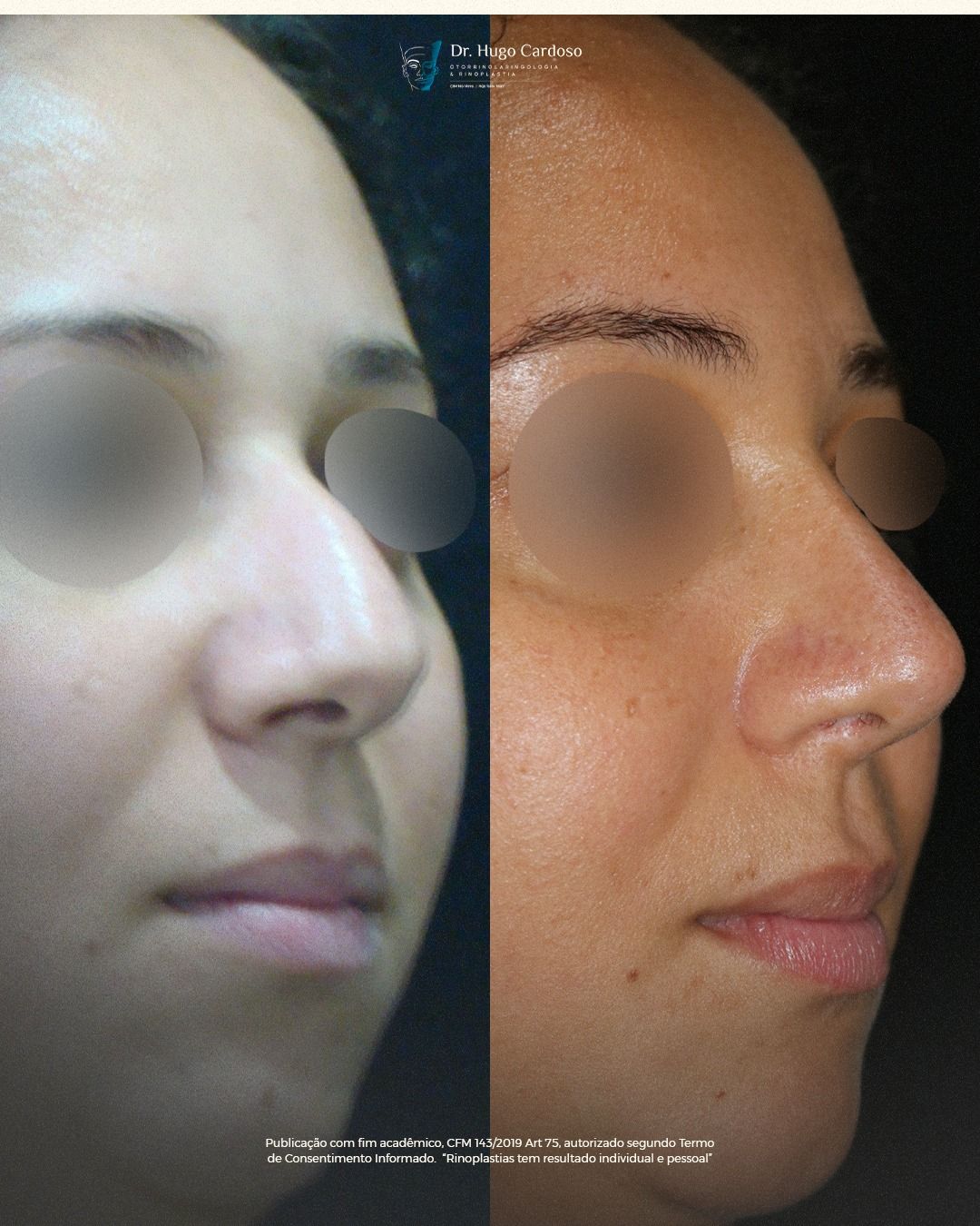 Hugo Cardoso De Oliveira-16