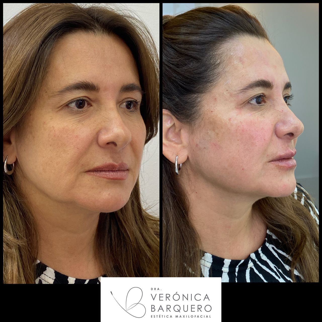 Veronica Maria Barquero Figueroa-20