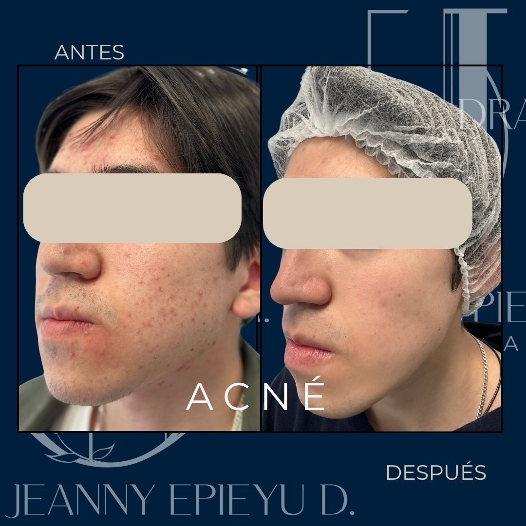 Jeanny Epieyu Diaz-4