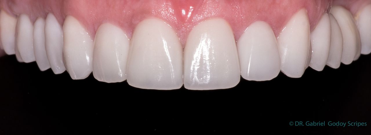 Gabriel Godoy Scripes-83