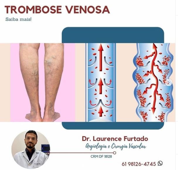 Laurence Furtado E Souza-6