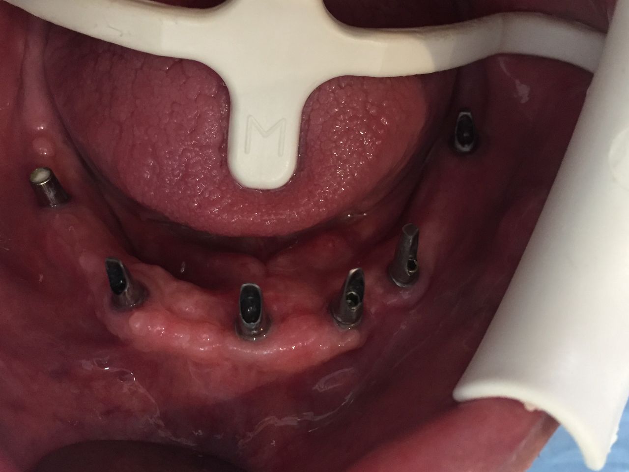 Isail Klahr Averbuch-3