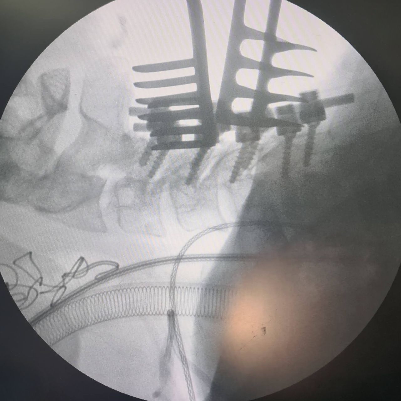 David Tafur Muñoz-1269