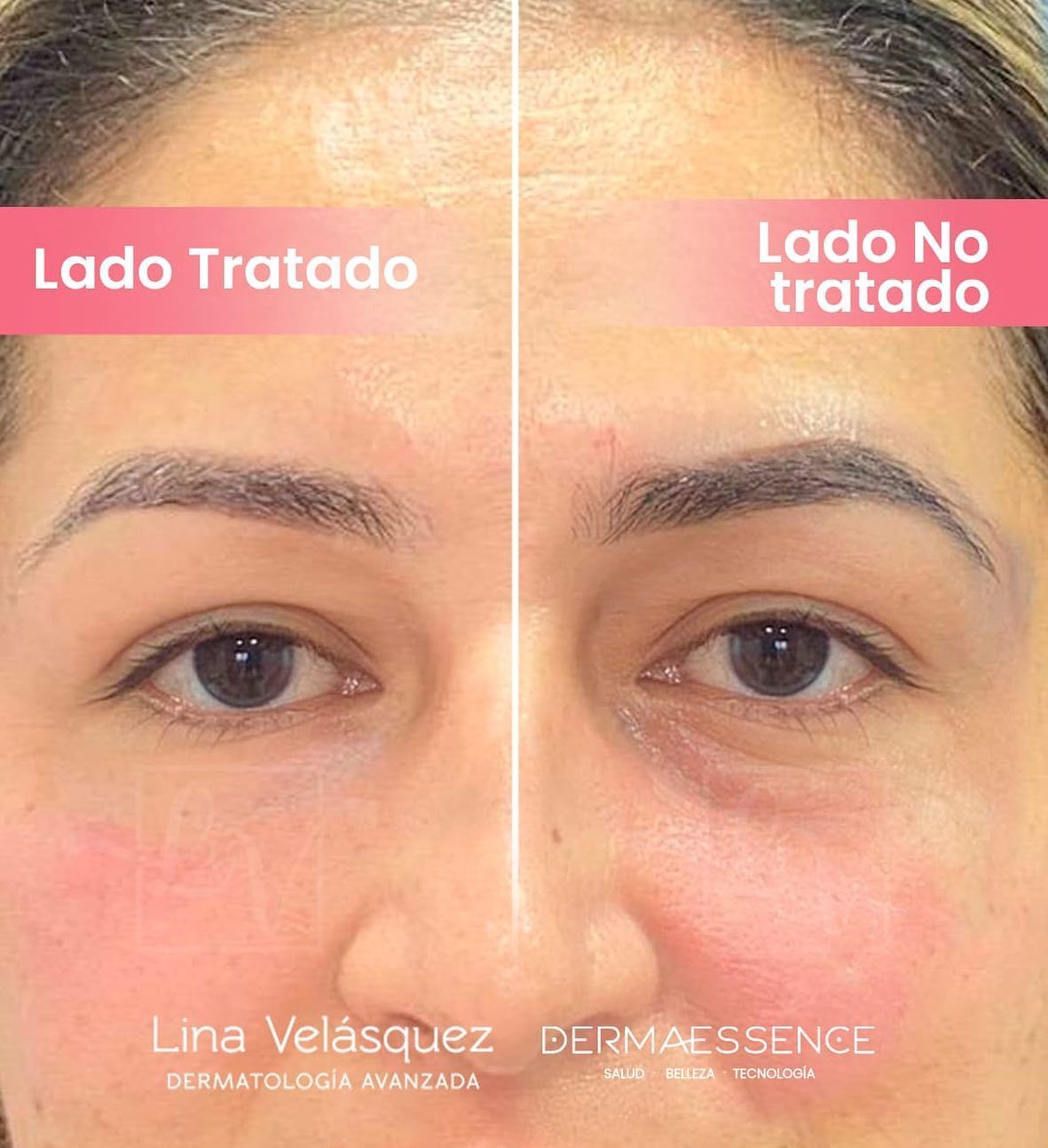 Lina Velásquez Tafur-7