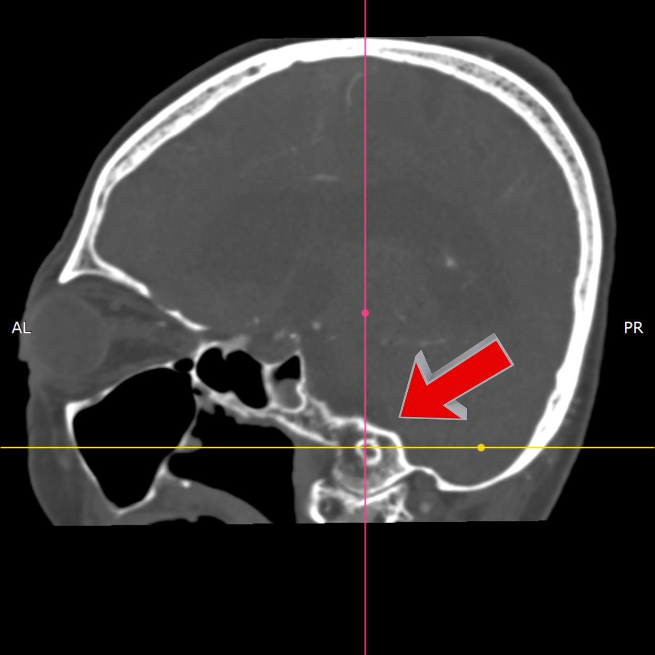 David Tafur Muñoz-2293