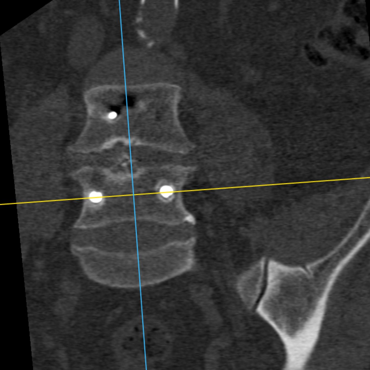 David Tafur Muñoz-1496