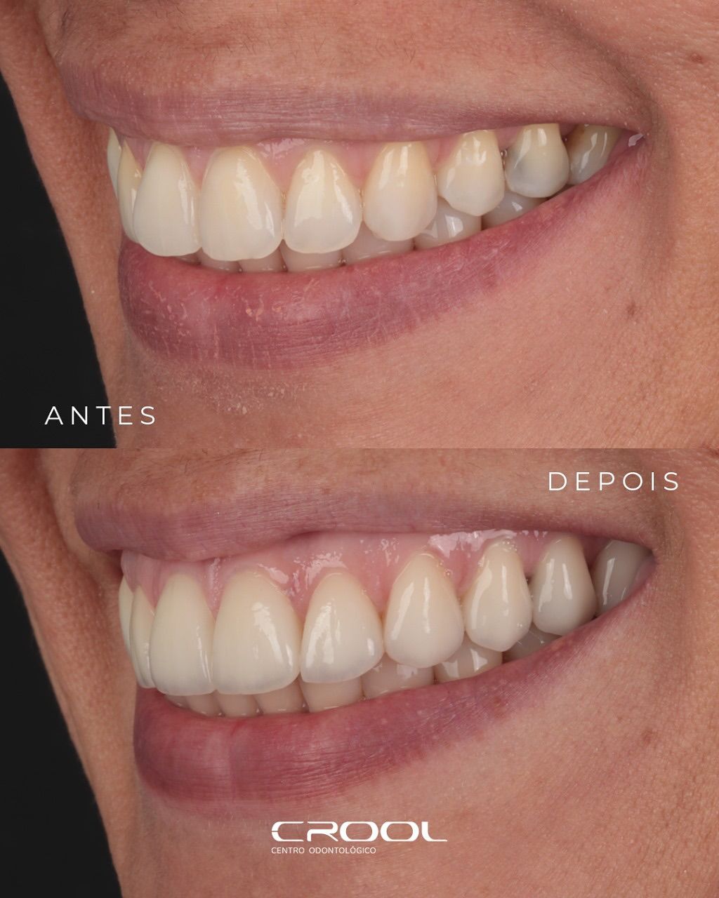 Frederico  Coelho-11