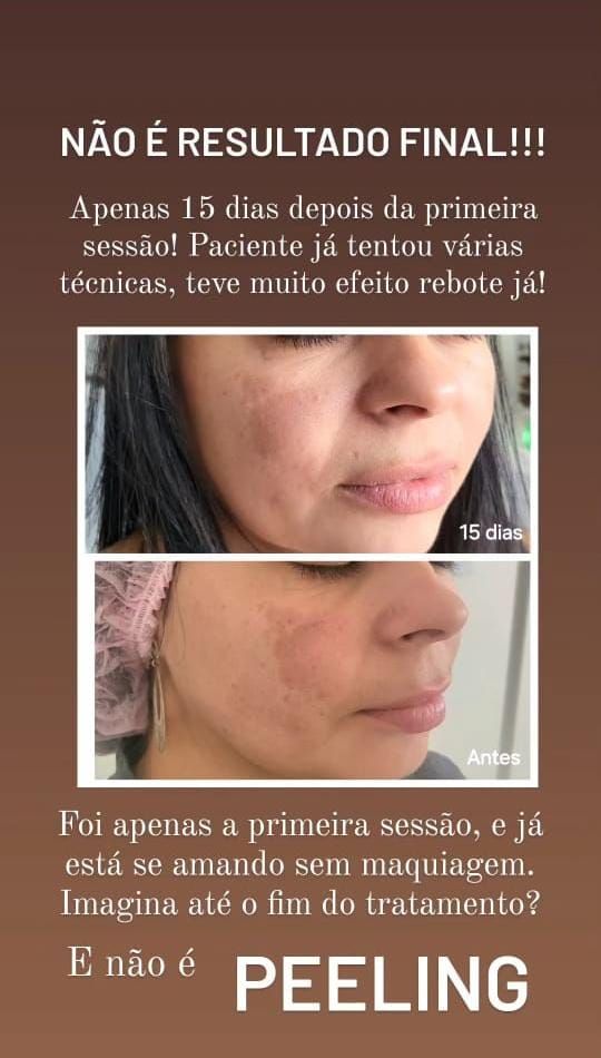 Ana Paula Andreolla-4