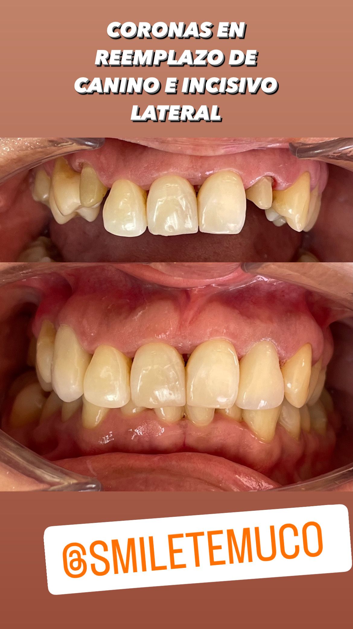 Luis Muñoz Tolhuysen-5