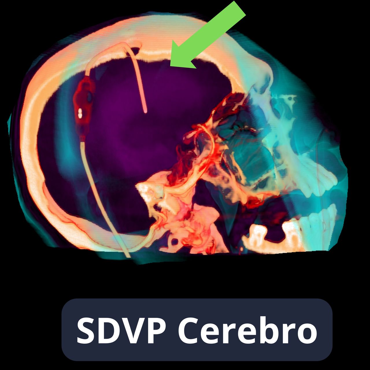 David Tafur Muñoz-2360