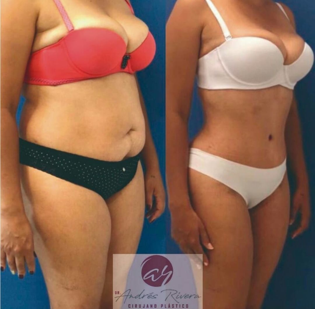 Andrés Rivera López-56