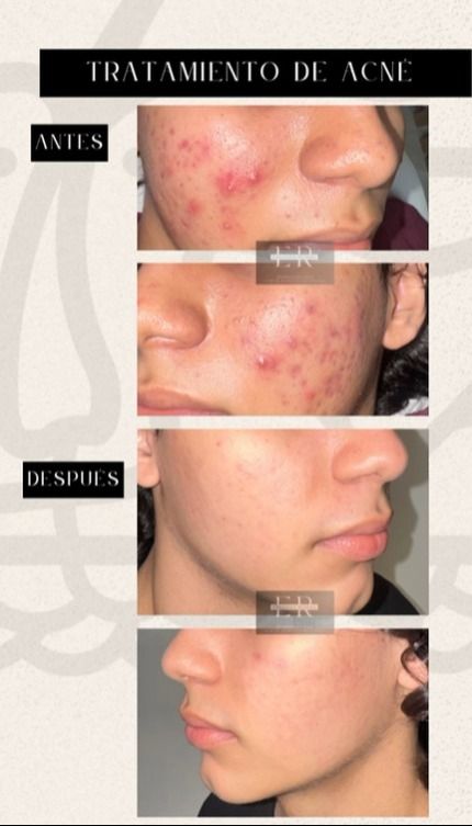 Eduardo Rivera Perdomo-16