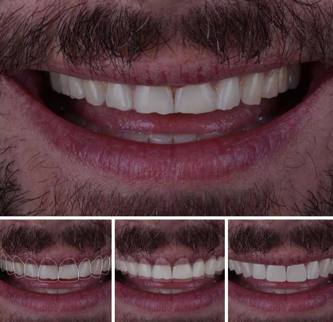 Patricia Christine Pinto-7