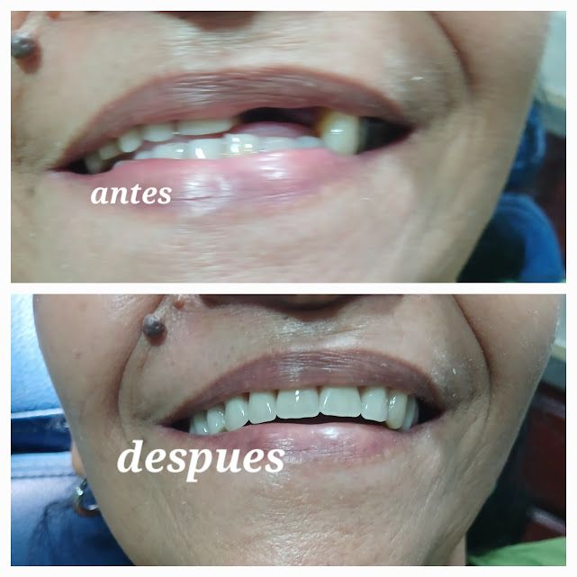 Rodolfo Nelson Olivo Gutierrez-7