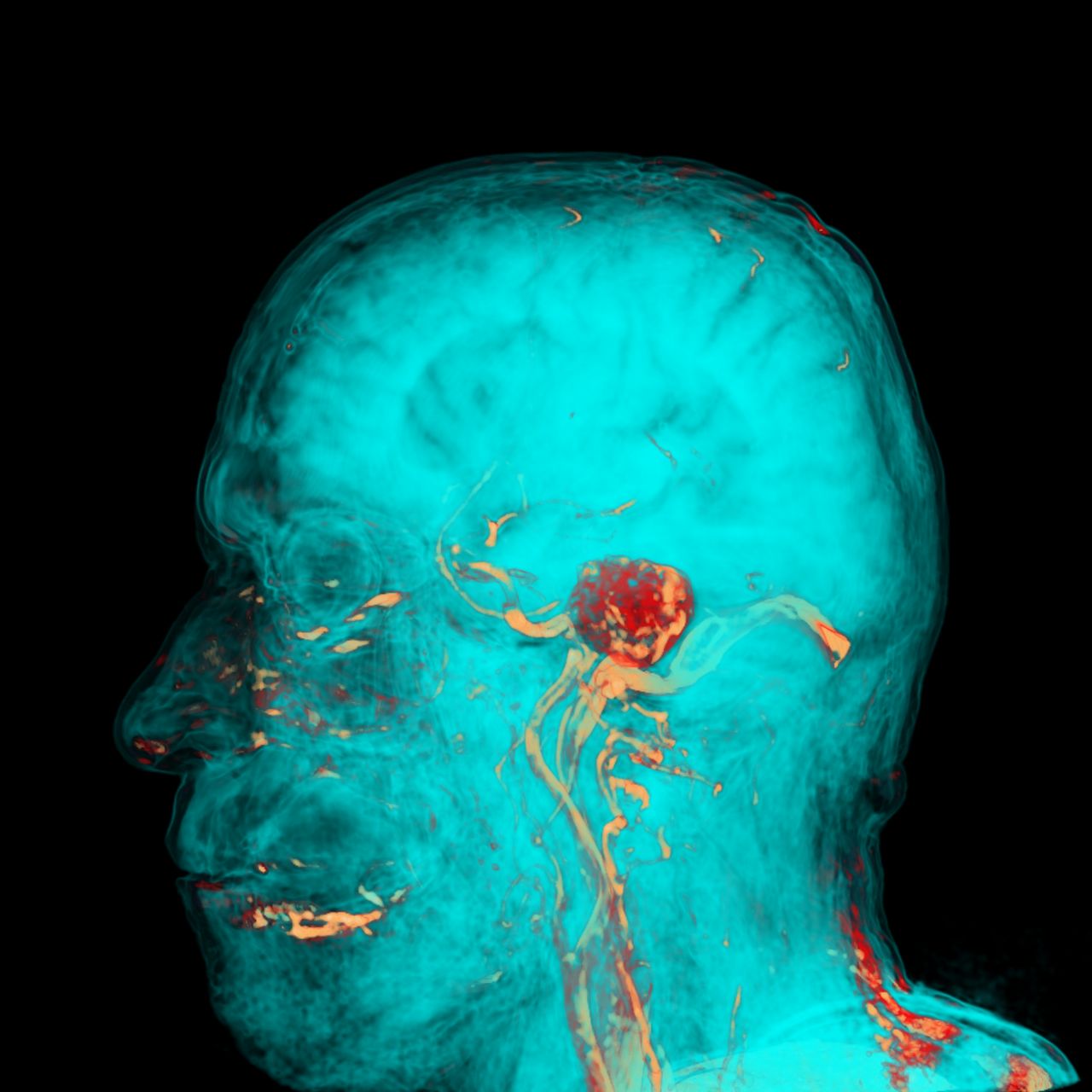 David Tafur Muñoz-1283