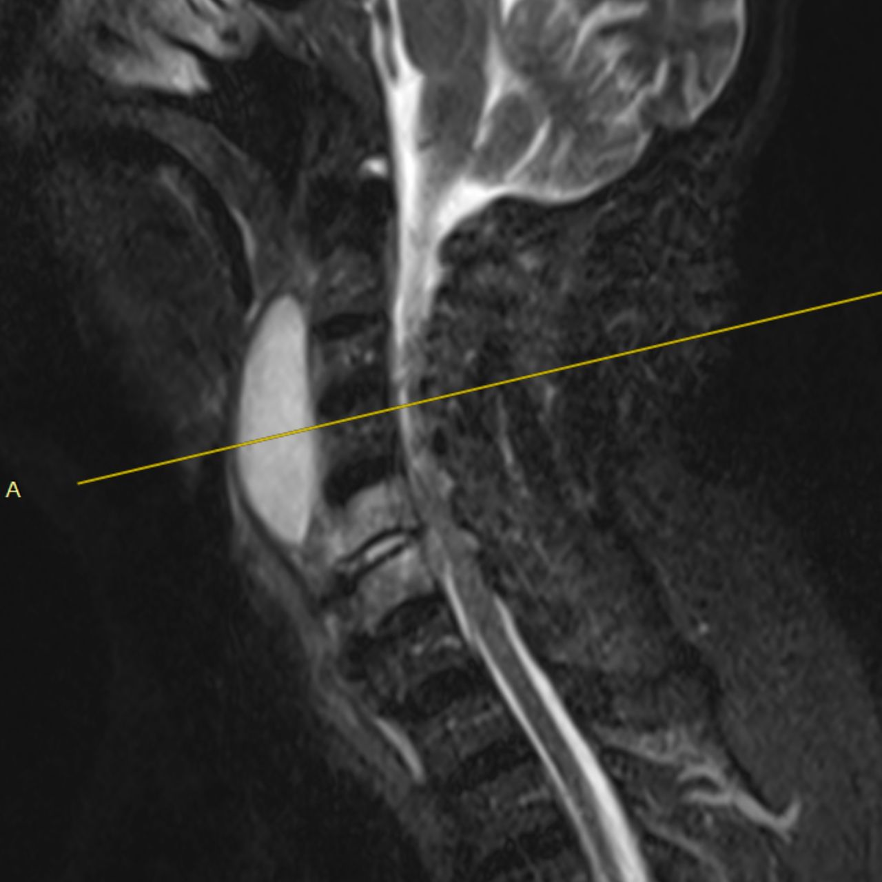 David Tafur Muñoz-2416