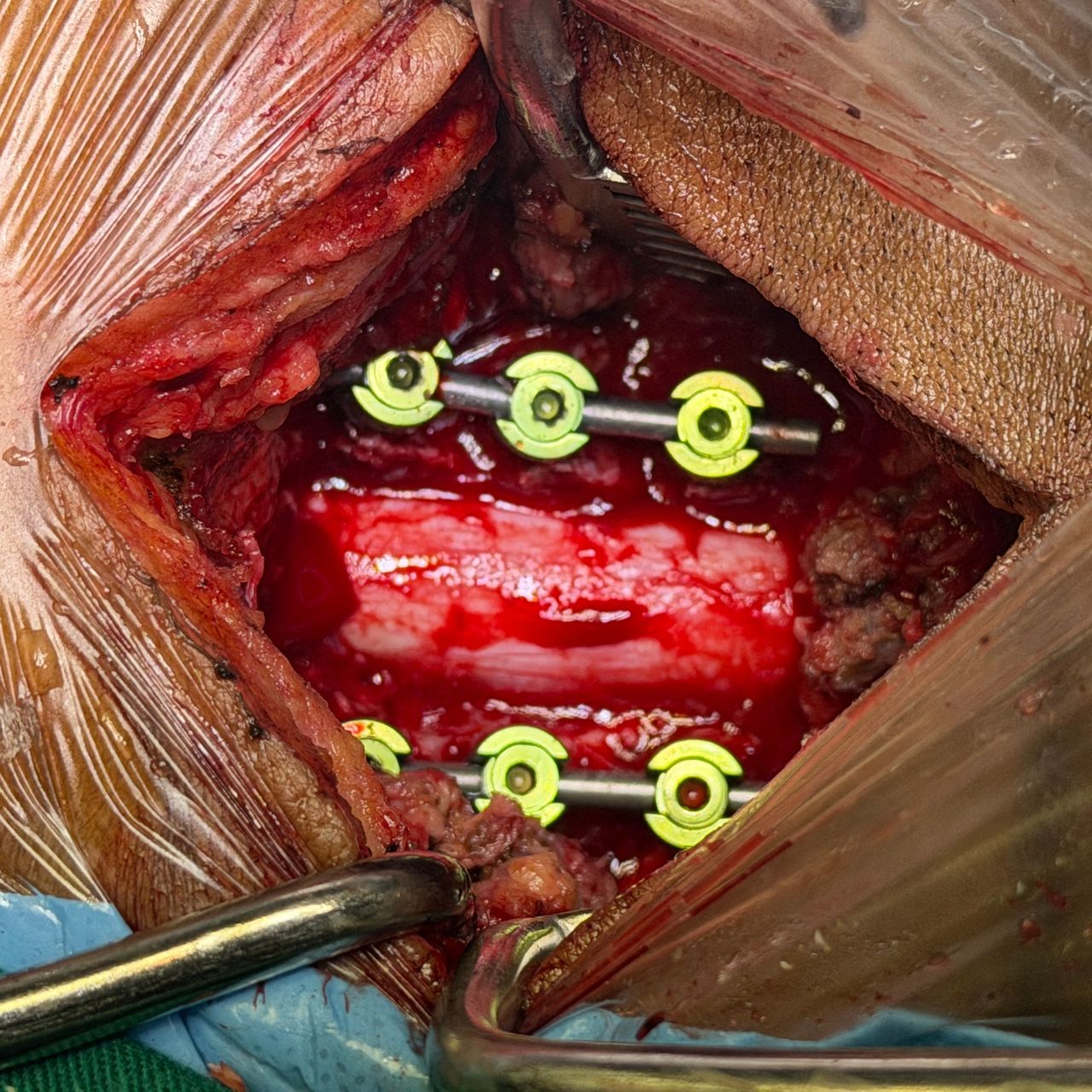 David Tafur Muñoz-2424