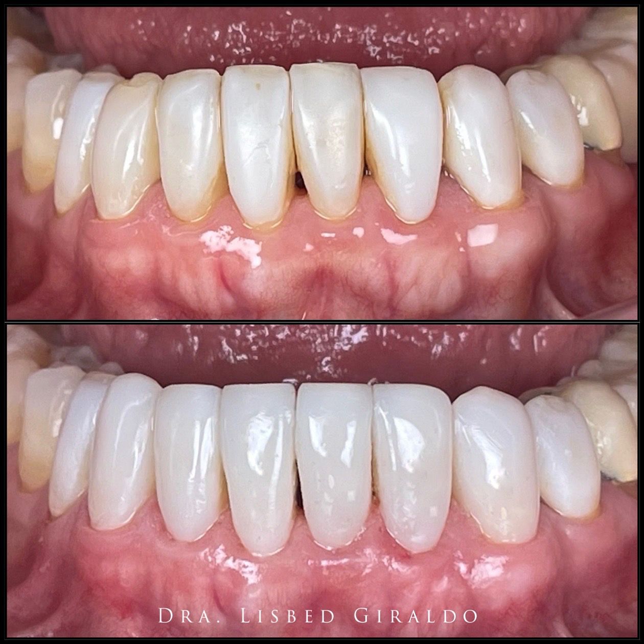 Lisbed Giraldo Olarte-20