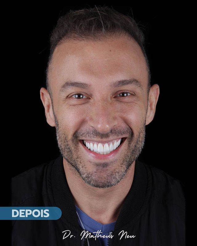 Matheus Da Silveira Neu-3