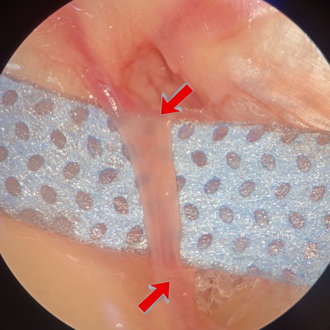 David Tafur Muñoz-2091