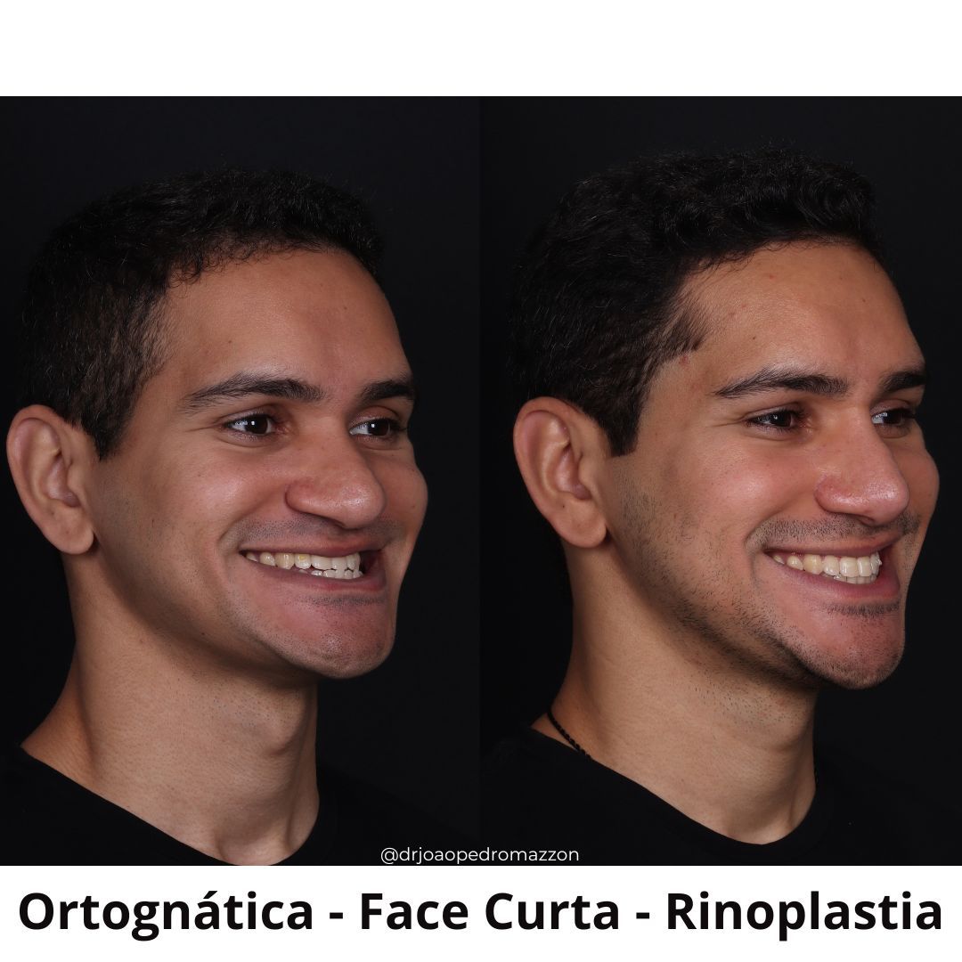 João Pedro Paulino Mazzon-16