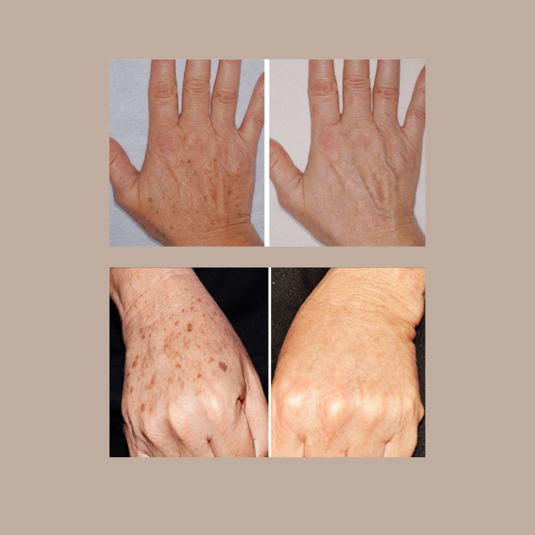 Mónica Hernandez Bulla-11