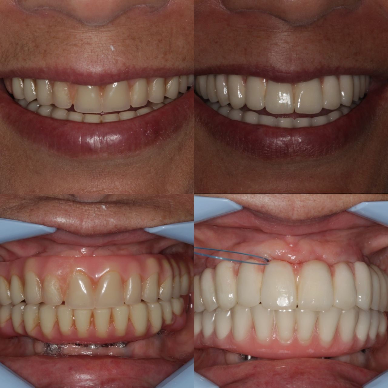 Antônio Alegria Do Nascimento-9