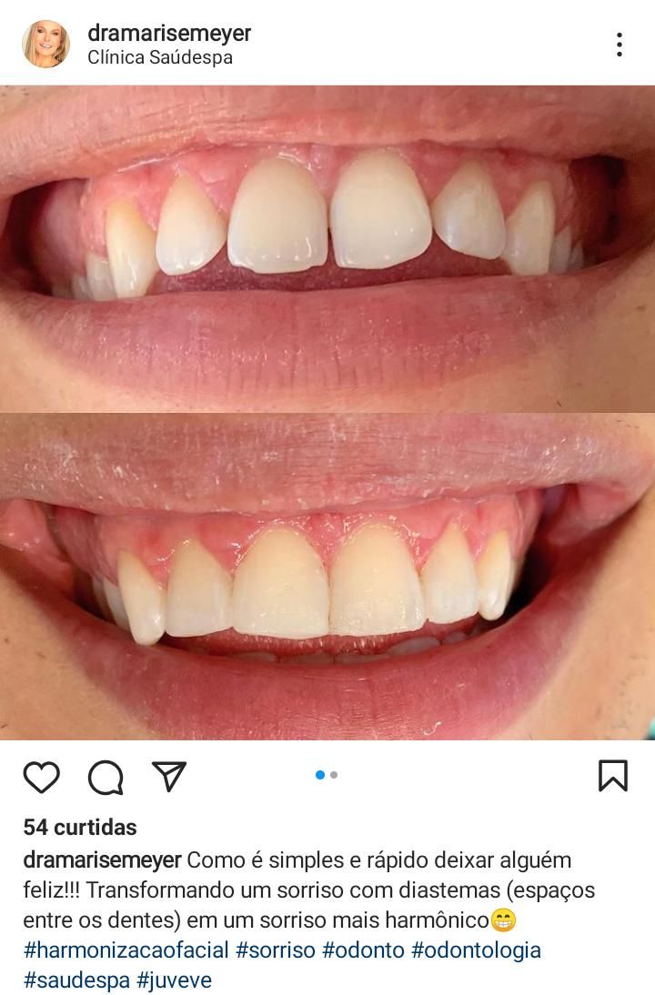 Marise Meyer Jamur-5