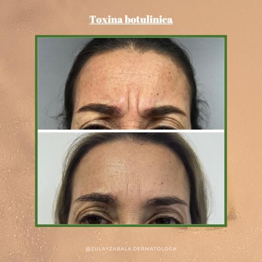 Zulay Angelica Zabala Suarez-39