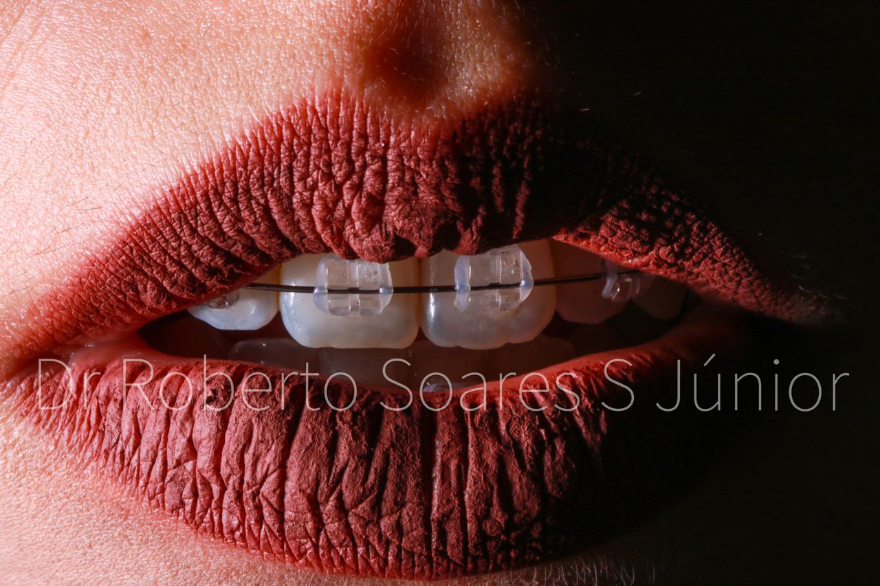 Roberto Soares Da Silva Júnior-7