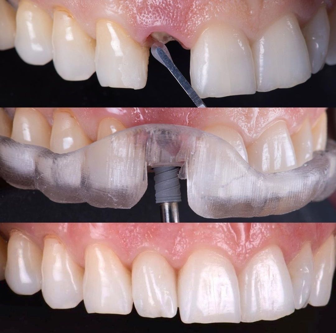 Ana Virginia  Pinheiro -7