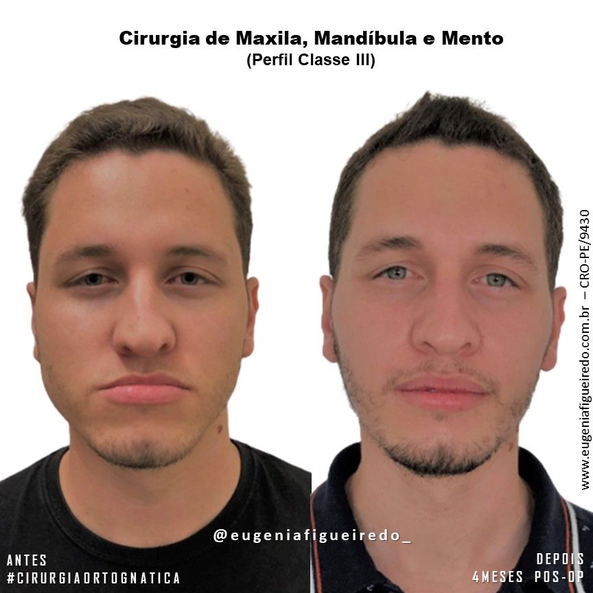 Eugênia Figueiredo-14