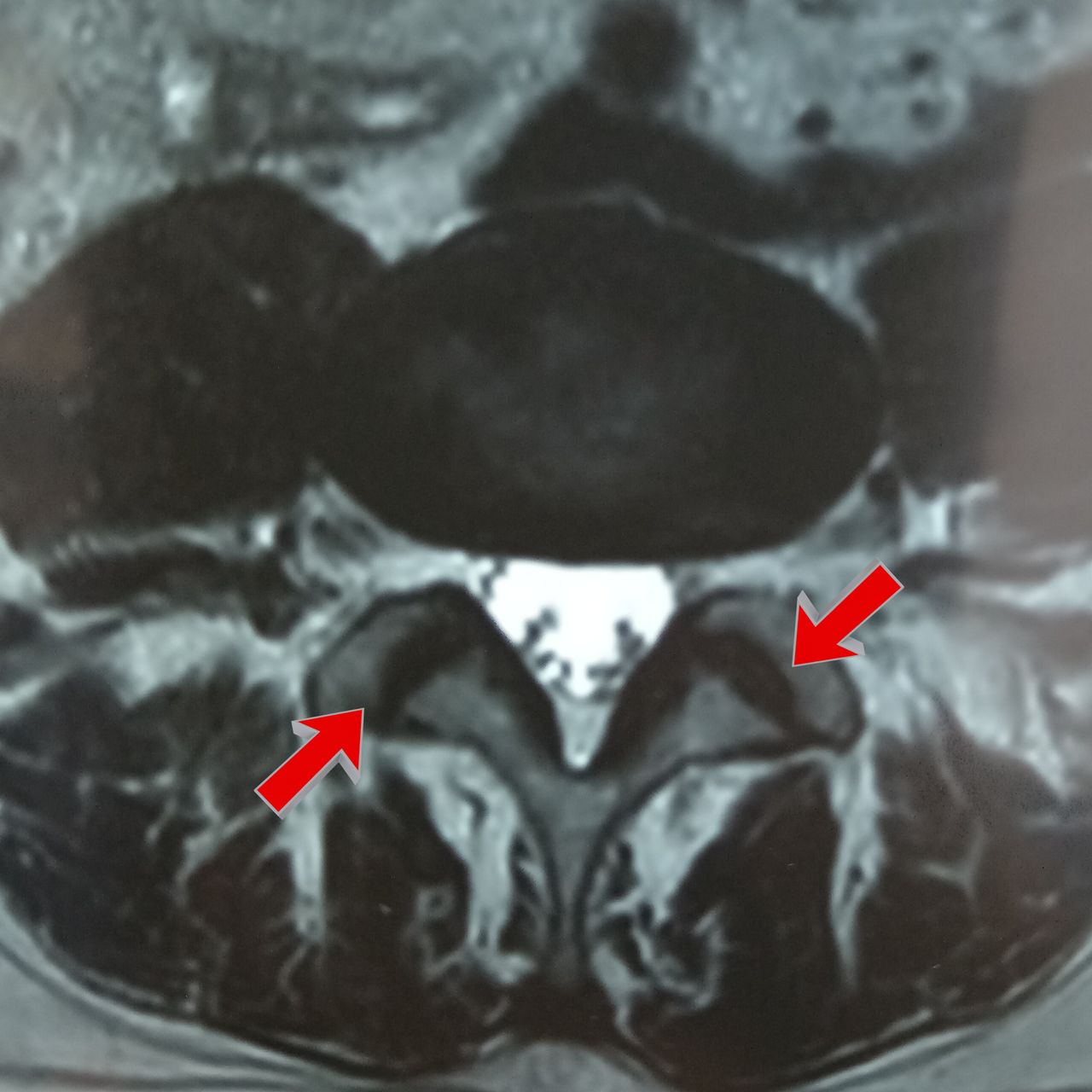 David Tafur Muñoz-1408