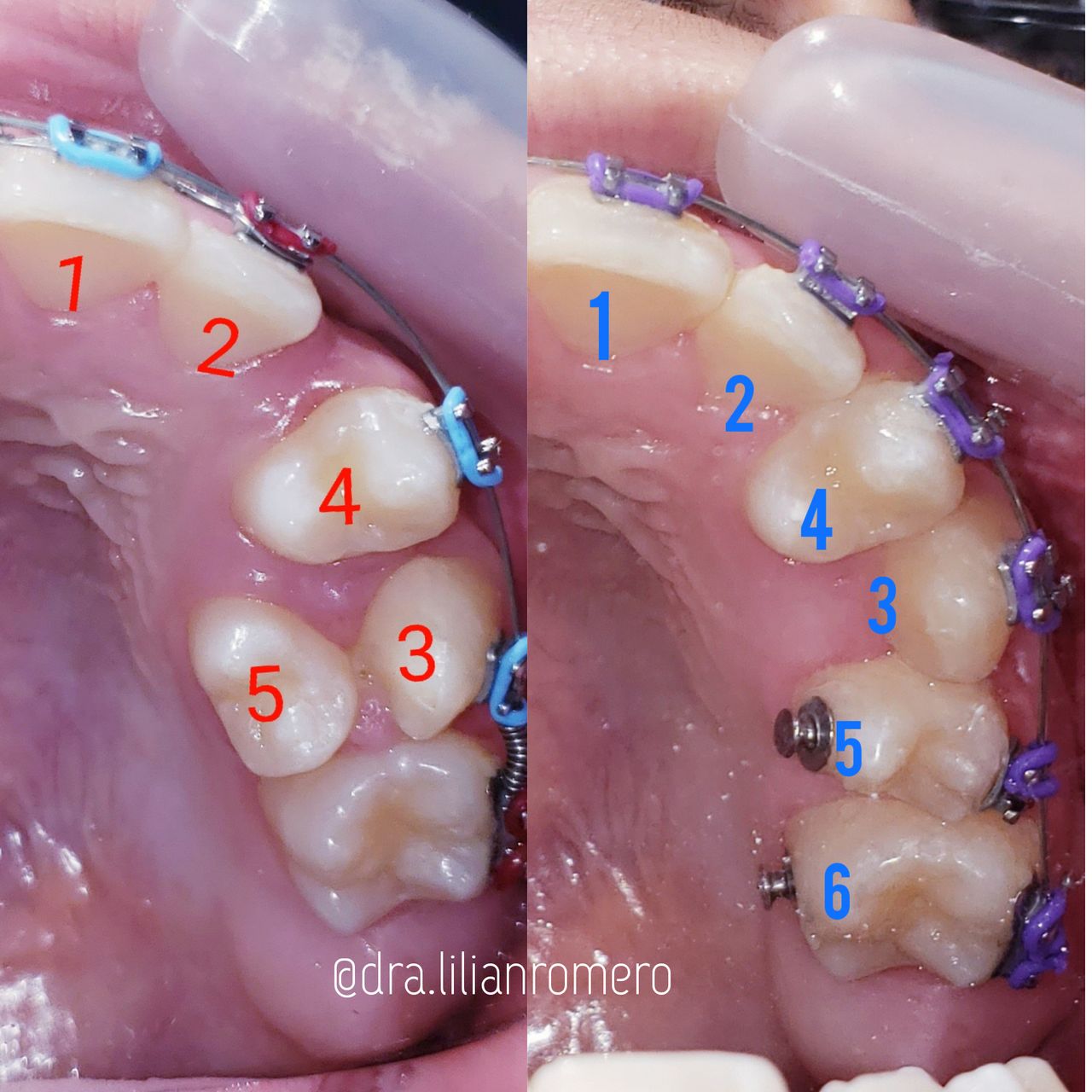 Lilian Catalina Romero Diaz-14