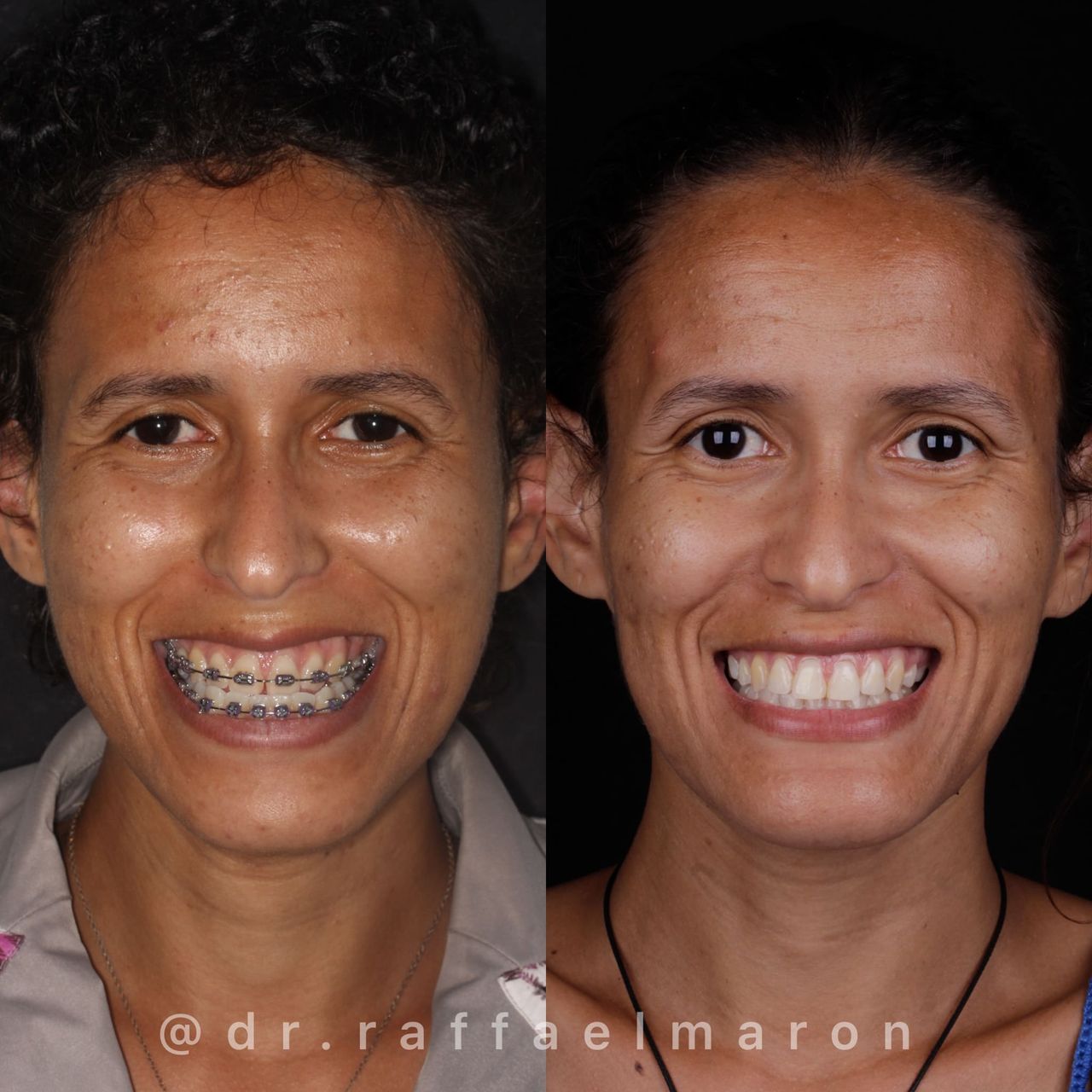 Raffael Maron Vieira De Noronha-25